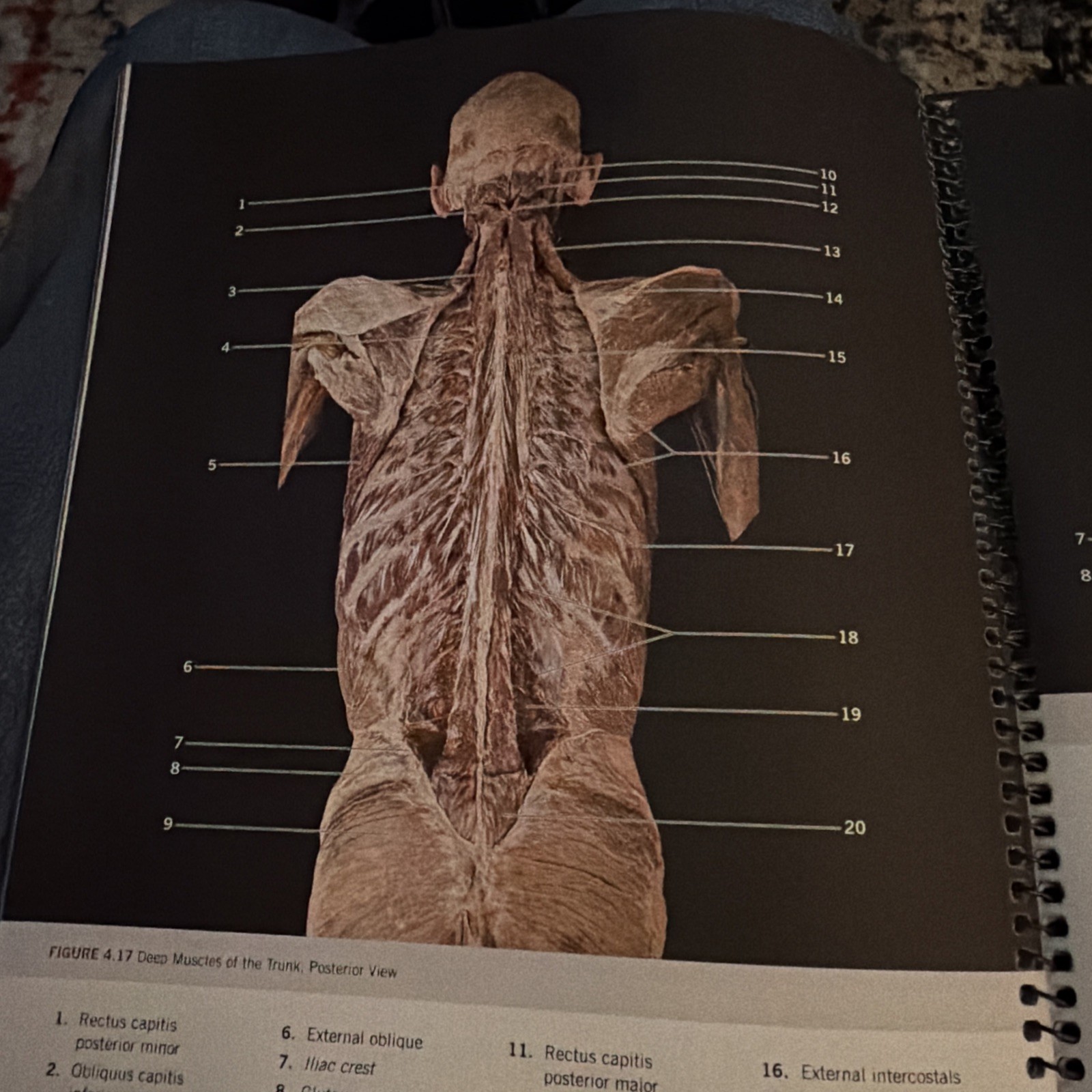 (SHRINK-WRAPPED. INSTRUCTOR’S COPY) PHOTOGRAPHIC ATLAS FOR ANATOMY & PHYSIOLOGY.