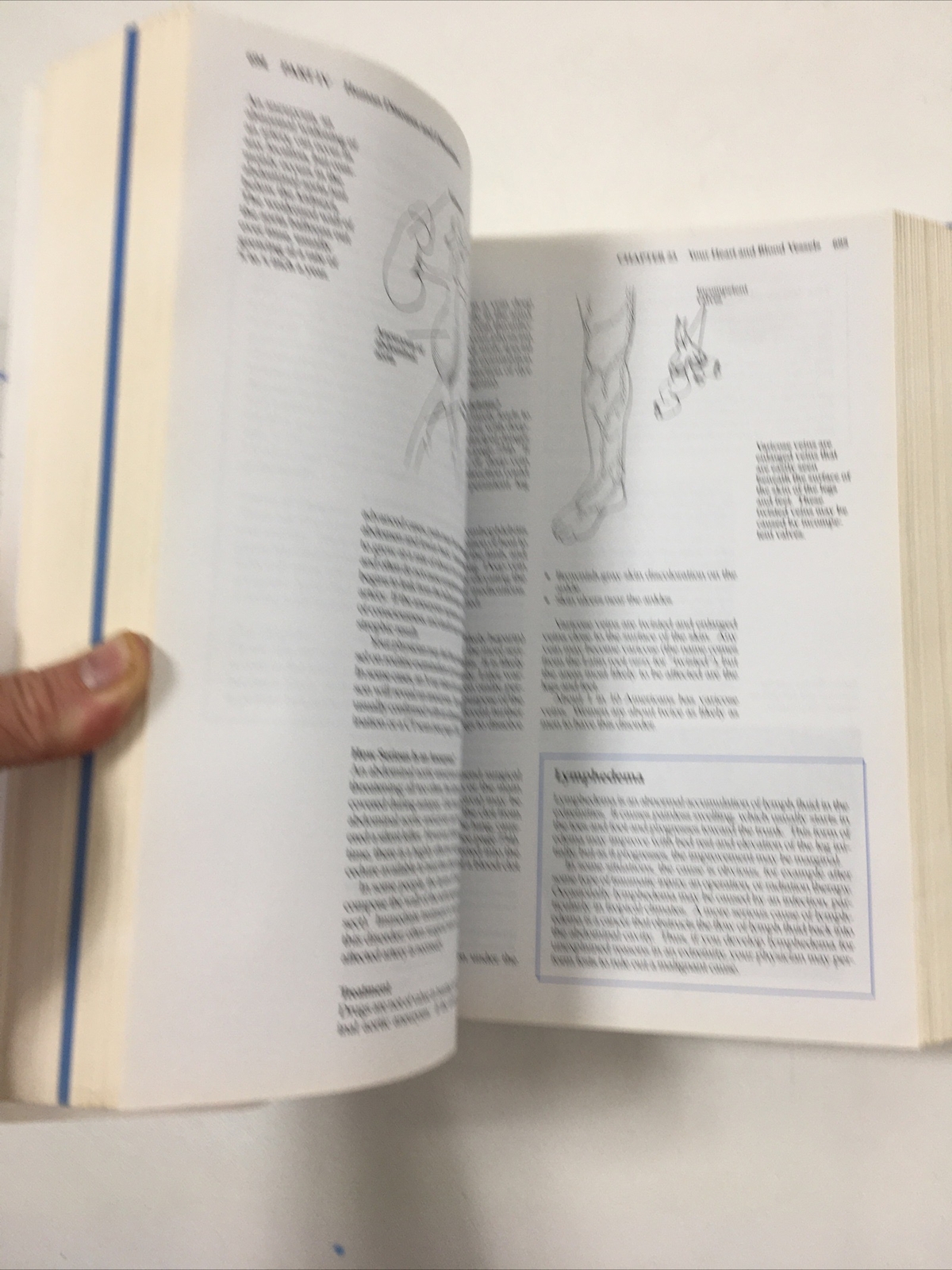 Mayo Clinic Family Health Book – David E. Larson, M.D. (Hardcover, 1996)